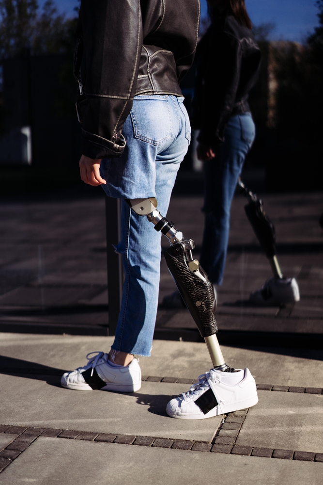 Young,Woman,Student,With,Prosthetic,Leg,Walking,In,University,Campus.